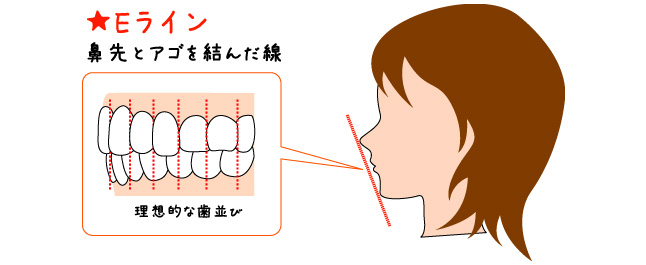 Eライン